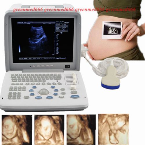 2015 12.1 inch Full Digital Portable Ultrasound Scanner +Convex Probe 3D Station