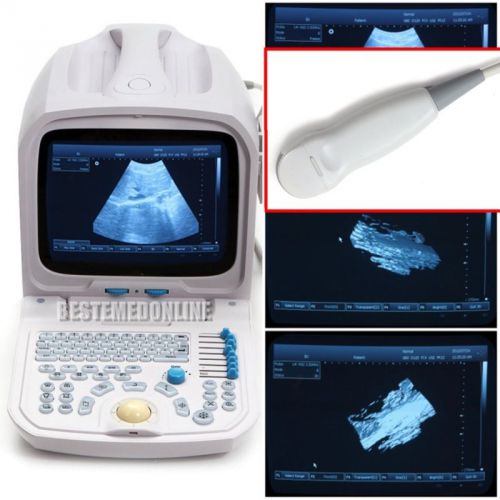 SALE 40% OFF!   PC Built_in 3D Ultrasound Machine Scanner+MICRO-CONVEX probe ca