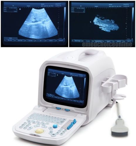 CE PC Platform Full Digital Portable Ultrasound Scanner Machine+Convex Probe ca