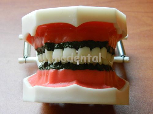 ADULT TYPODONT DENTAL MODEL TEETH  FLEXIBLE GUM STUDY TARTA CALCULUS PLAQUE