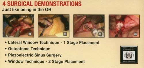 American Academy of Implant Dentistry - Focus on the Sinus - 4 DVD Set - Dental