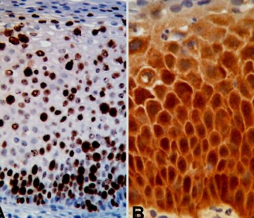 Control Slides - 10 Unstained Human HPV HR IHC/ISH