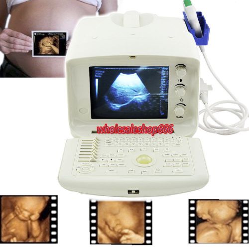 Dynamic full Digital Portable Ultrasound Scanner+ convex probe + 3D work station