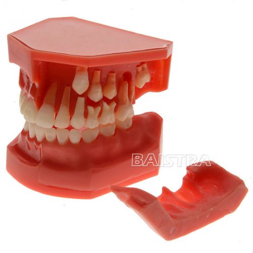 Dental Teeth Model Deciduous Permanent Alternate Demonstration Study Teach HKDO