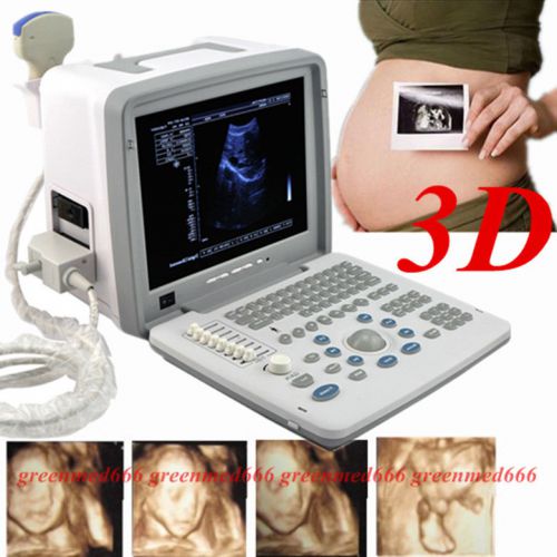 Free3D+Full Digital Portable Ultrasound Scanner +Convex Probe ClearImage Warraty