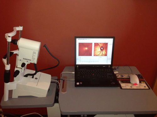 Heidleberg hrt3 optic nerve glaucoma scanner includes computer, software &amp; table for sale