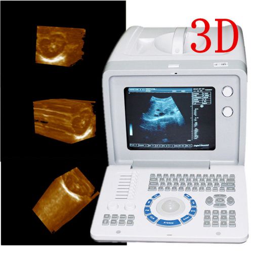 Full Digital portable Laptop Ultrasound Scanner machine + 3.5mhz Convex Probe