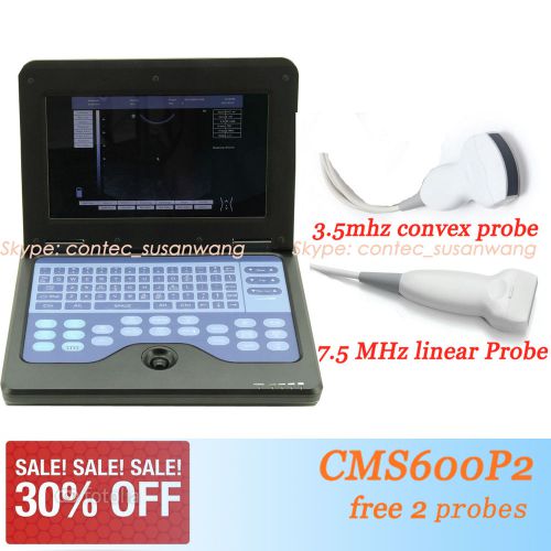 HOT SALE!Notebook/Laptop Ultrasound Scanner, 3.5mhz Convex + 7.5mhz linear probe