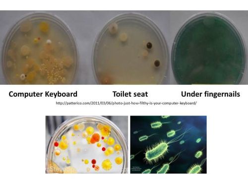 10g Nutrient Agar w/Yeast Extract, Peptone Petri Dish Student Science Fair