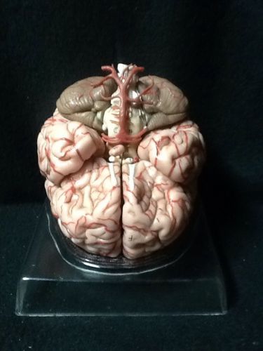 SOMSO BS23 Human Brain with Arteries Anatomical Model, 9 part (BS 23)