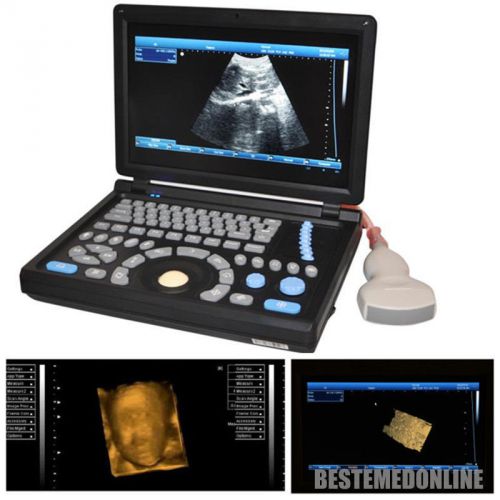 Hot 3D Full-digital Ultrasound scanner machine W CONVEX +2 connectors+2USB ports