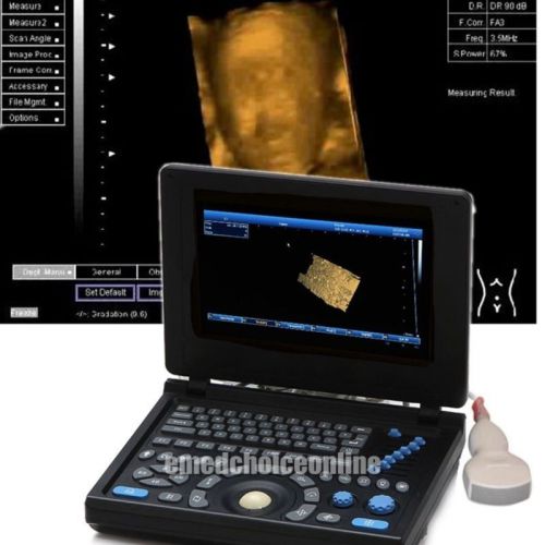 NEW Full Digital TFT LCD Ultrasound Scanner High-resolution (built-in 3D) CONVEX