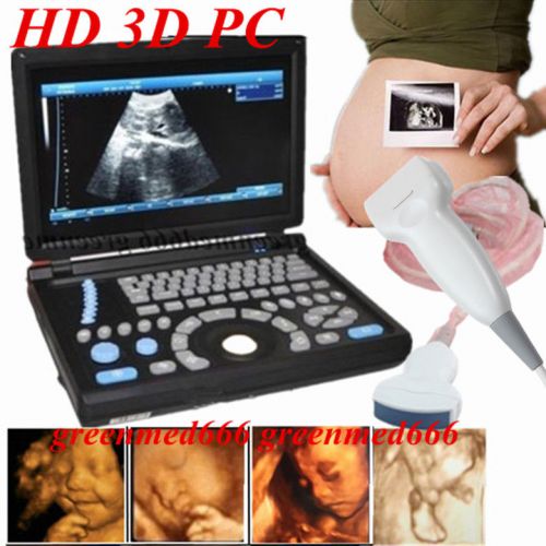 10.4inch 3d full digital laptop ultrasound scanner+convex &amp; linear probe pc fda for sale
