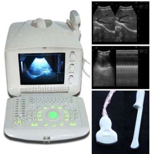 3D Digital Ultrasound Scanner +Convex TV 2 probes Optional 2 probes+3 years warr