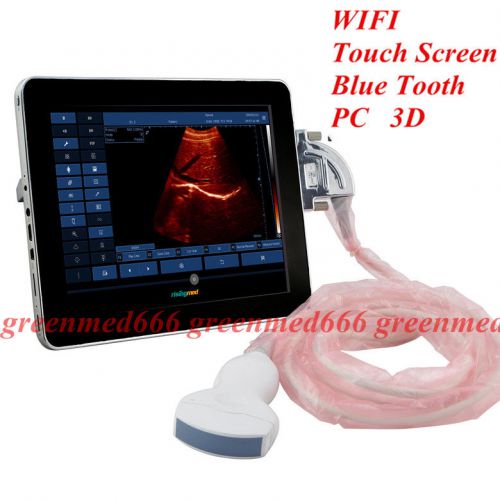 10&#039;&#039;HD Full Digital B&amp;W Touchscreen Upad Ultrasound Scanner with Convex Probe