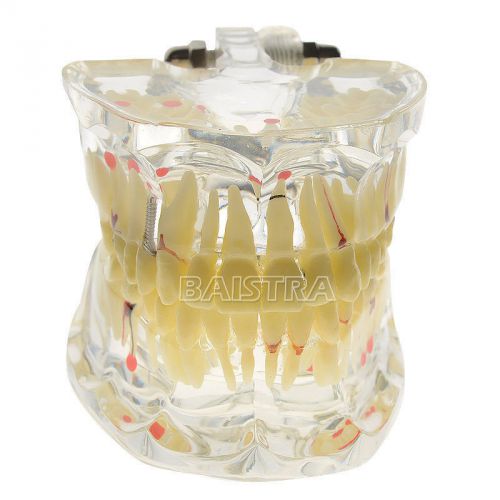 New Dental Study Teeth Model Transparent Adult Pathological #4001-I