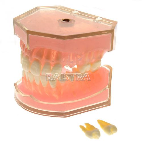 Dental Teeth model Standard teeth model removed study teach Model #4004 !!!