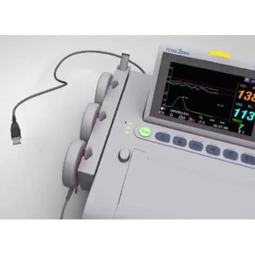 Wallach Fetal2EMR Insight Connection Cable