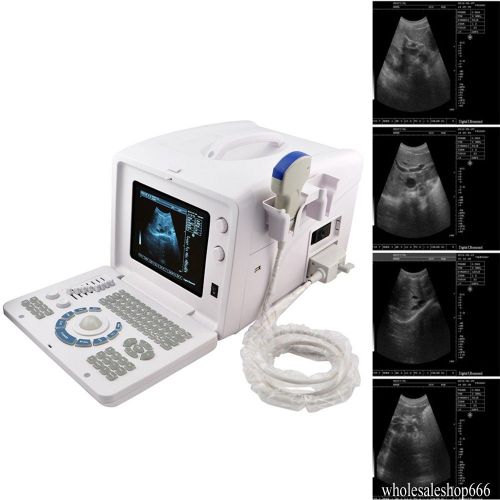 3.5 mhz convex probe +portable digital ultrasound scanner machine system free 3d for sale