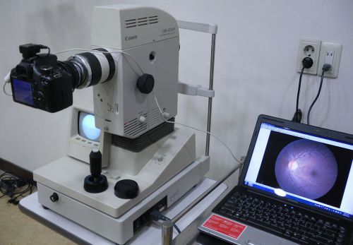 CR6-45NM NM RETINAL CAMERA-DIGITAL CONVERTED