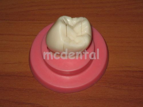 OVERLAY DENTAL INLAY ONLAY TYPODONT DEMOSTRATATION MACRO MODEL  TEETH