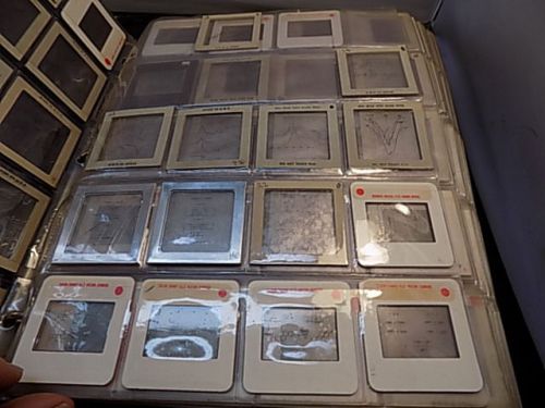 Vintage Medical Educational  Slides - Rare Set