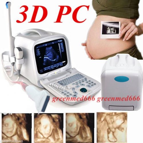 3D PC platform Ultrasound Scanner +7.5MHz Linear &amp;Transvaginal 2 Probes Internet