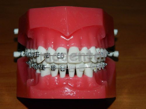 Dentoform orthodontic adult braces typodont demostration model teeth for sale