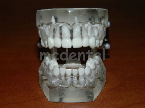 NEW PEDIATRIC CHILD TYPODONT DENTAL MODEL TEETH REMOVABLE CLEAR ACRYLIC