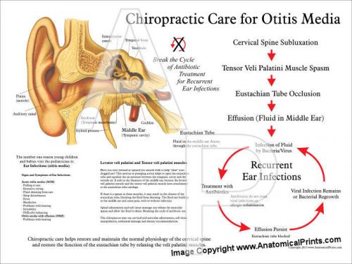 Chiropractic Care for Otitis Media Poster 18&#034; X 24&#034; Wall Chart