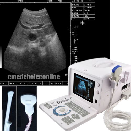 3D Station Digital Ultrasound Scanner w Convex Transvaginal 2 probes+100%WARRANT