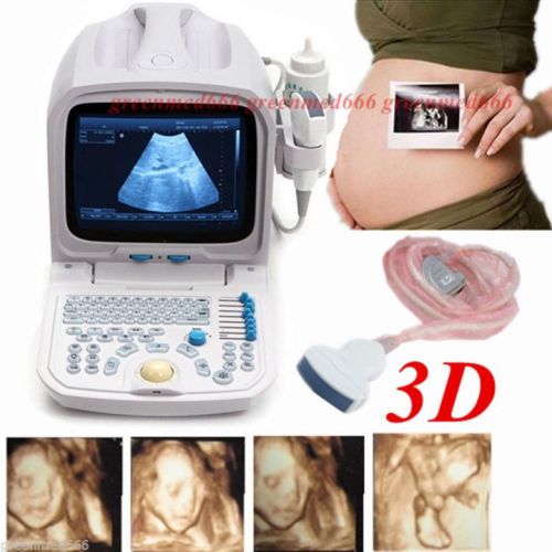 3D PC Platform Full Digital Portable Ultrasound Scanner Machine +Convex Probe CE