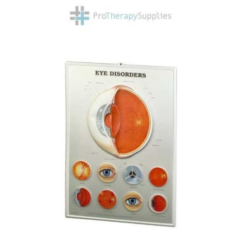 Anatomical Chart Company Eye Disorders 3D Lenticular Anatomical Chart