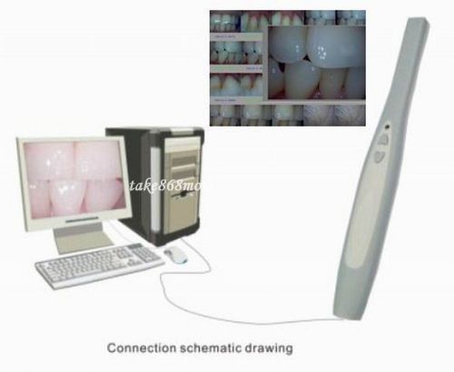 1PC New Dental 2.0 Mega Pixels Intraoral Oral Dental Camera USB Model MD740