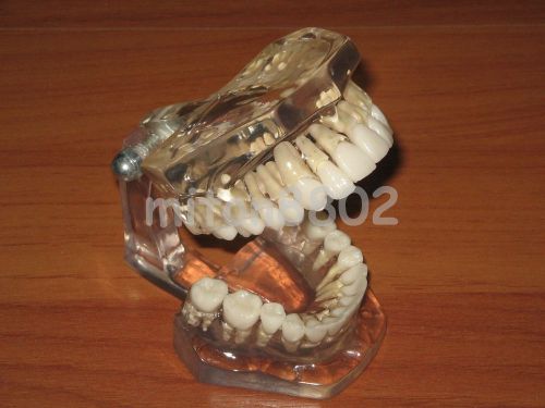 NEW ADULT TRANSPARENT TYPODONT ACRYLIC DEMOSTRATION MODEL STUDY TEETH TOOTH