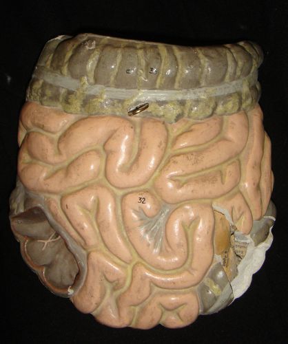 RARE Antique German Intestine Colon Anatomical Model Plaster Paper Mache