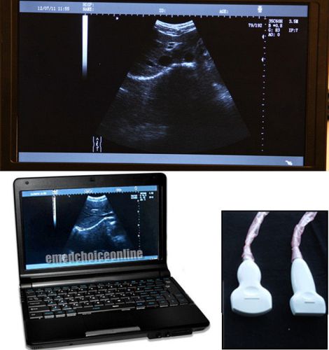 CE FUll Digital +3D Laptop Ultrasound Scanner+** Convex probes and linear probe