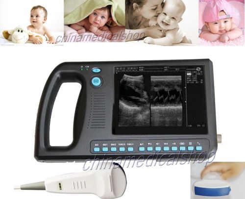 NEW Palm Smart B-ultrasound ultrasound Scanner System + convex/abdominal probe