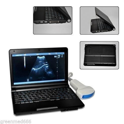 10.1-inch LCD Notebook Ultrasound machine scanner +Convex probe/transducer 2015