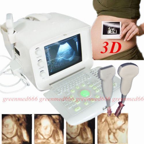 CE 3D Digital Diagnostic Ultrasound Scanner Machine +Convex &amp; Linear Probe FDA