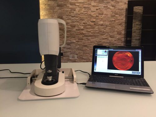 I-optics ioptics easyscan retinal imagining slo digital fundus camera w laptop for sale