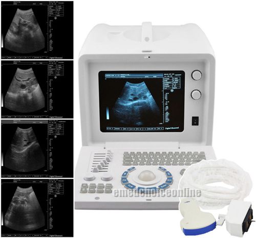 2015newest 3d station+ digital ultrasound scanner portable diagnostic machine for sale