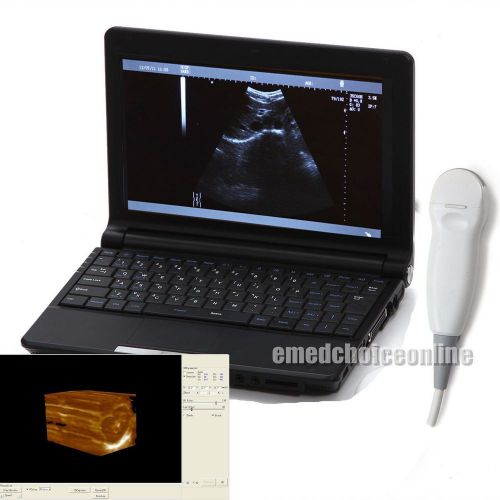 3D Laptop Digital Ultrasound machine Scanner 5.0 Mhz Micro-convex 3D workstation