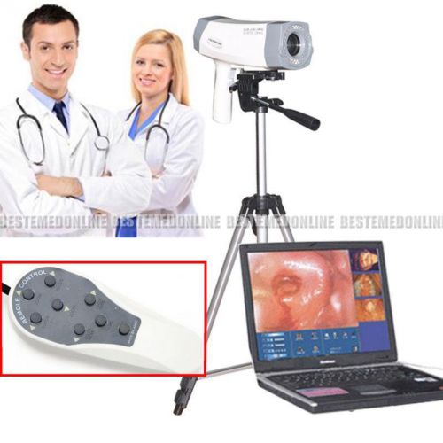 Portable Digital Electronic colposcope SONY 800,000 pixels newest Version+Tripod