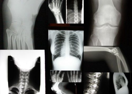 LOT 17 REAL HUMAN X RAYS XRAY BONE FREAKY HAUNTING ART WEIRD UNUSUAL TWISTED