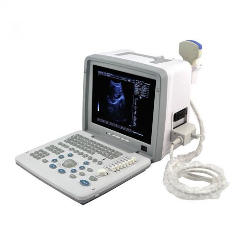 Factory Full Digital Portable Ultrasound Scanner + Convex Probe+ 3D Station