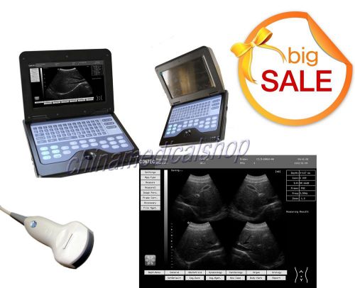 New portable laptop b-ultrasound scanner machine with three probes for human use for sale