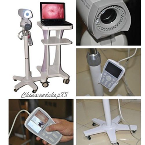 2015 New Software Digital Video 850,000 pixels Electronic Colposcope SONY Camera