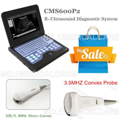 Contec cms600p2 ultrosound scanner, 2 probes ( convex and micro-convex probe) for sale