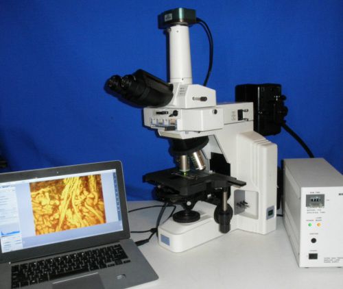 Nikon Eclipse E600 Fluorescence Phase Contrast Microscope